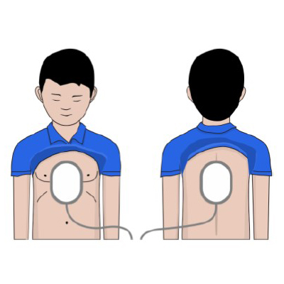 Electrodes for children AED Amoul