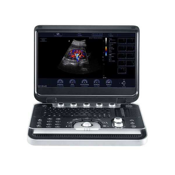 Finus 50 high-end portable ultrasound diagnostic system + 2 Focus&Fusion transducers
