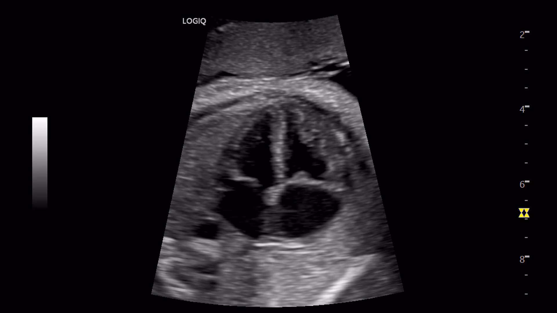 Ультразвуковий стаціонарний апарат експертного класу +2 датчика Logiq P9 GE Healthcare — изображение 5