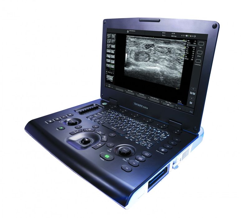 High-end portable ultrasound scanner + 2 transducers – Versana Active by GE Healthcare