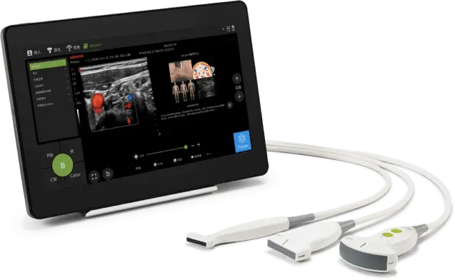 PILOTER PORTABLE ULTRASOUND SYSTEM by Shenzhen Wisonic Medical Technology