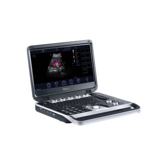 Finus 45 Focus&Fusion (China) – a mid-range portable ultrasound diagnostic system