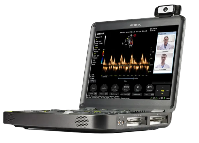 CLOVER 60 PORTABLE EXPERT-CLASS ULTRASOUND SYSTEM by Shenzhen Wisonic