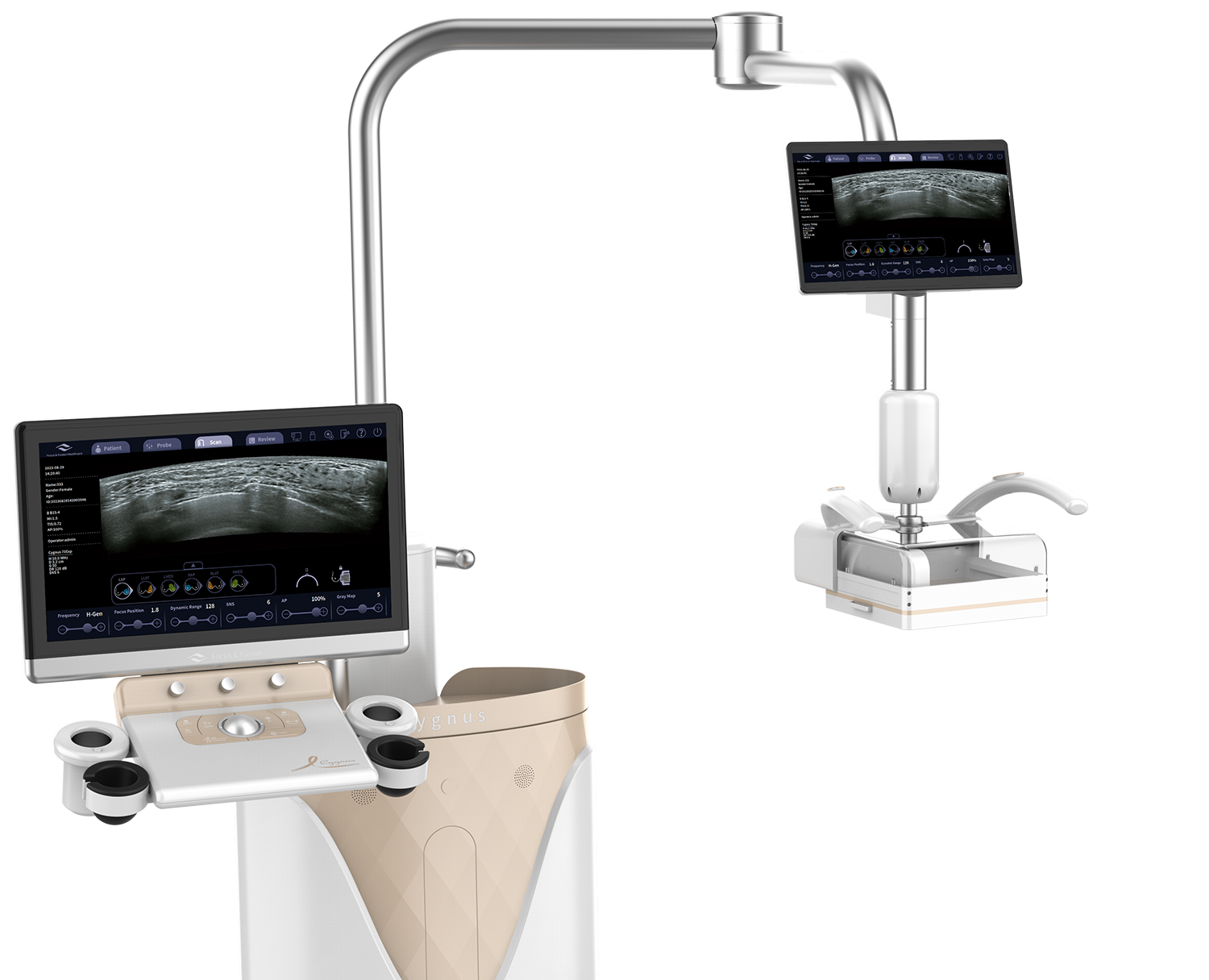 Автоматизована 3D-система ультразвукової діагностики молочних залоз Cygnus 70 Focus & Fusion (КНР) - Image 4