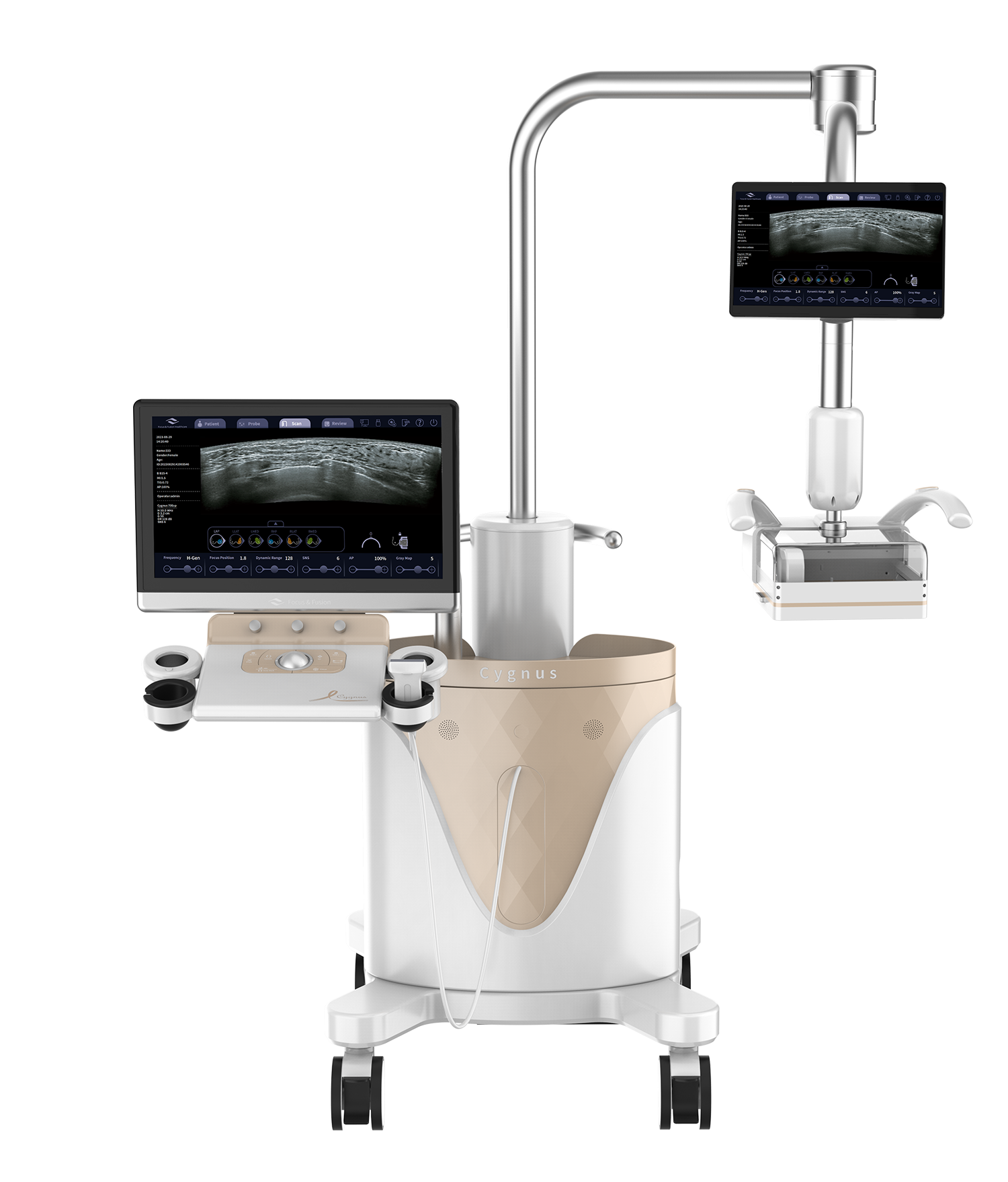 Cygnus 70 Focus & Fusion automated 3D ultrasound system for breast diagnostics (PRC)