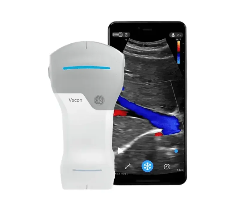 Portable ultrasonic device Vscan Air CL GE Healthcare (USA)