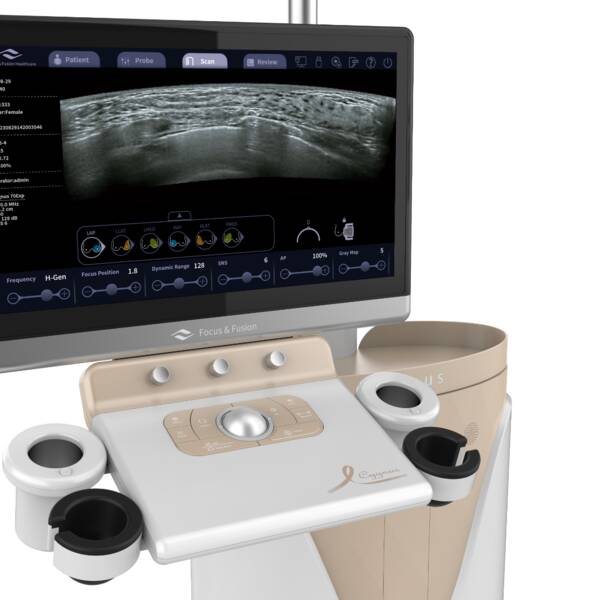 Автоматизована 3D-система ультразвукової діагностики молочних залоз Cygnus 70 Focus & Fusion (КНР) - Image 2